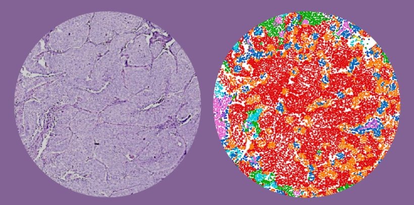 Der lila gefärbte Ausschnitt (links) zeigt die Eosin-Färbung...