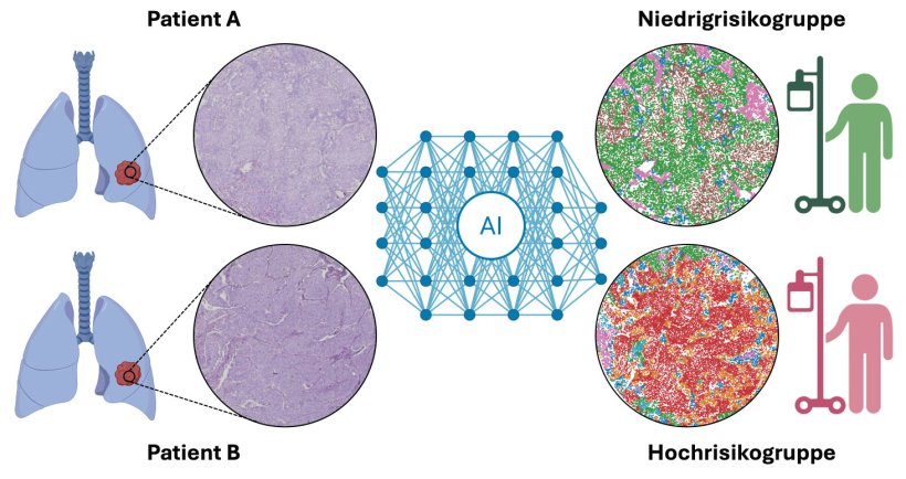 Das neu entwickelte KI-Verfahren unterstützt die Mediziner dabei, Patienten...