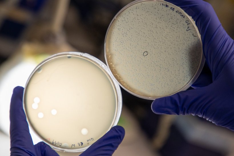Two petri dishes containing bacteria cultures held up by two hands in blue...