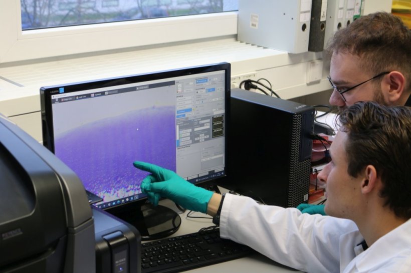 Entstehung von Kniegelenksarthrose auf der Spur