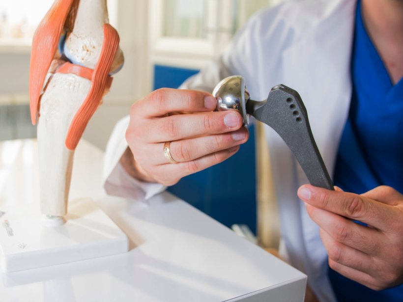 Ein Arzt hält ein künstliches Hüftgelenk in seinen Händen