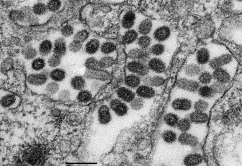 Transmission electron microscopy of H5N1 influenza virus