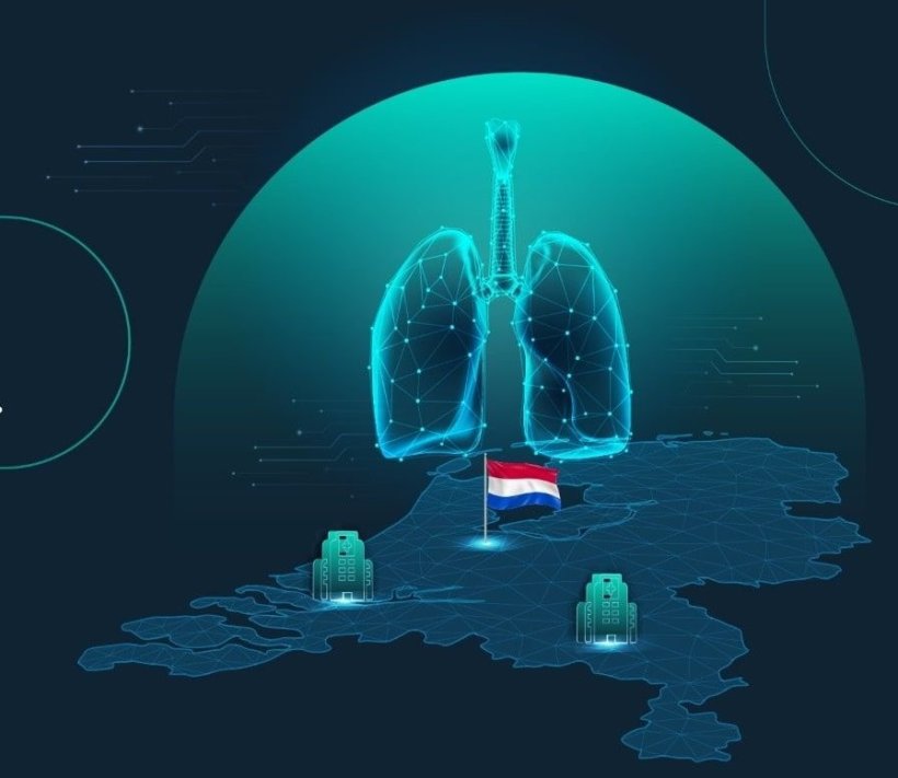 Two Dutch hospitals implement AI for lung nodule detection on chest X-rays