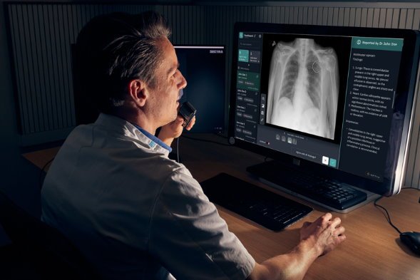 Dr Joost Nederend, Radiologist at Catharina Ziekenhuis viewing Qure.ai qXR on a...