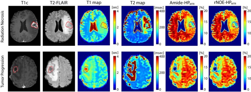 Postcontrast T1-weighted (T1c) and T2-weighted fluid-attenuated inversion...
