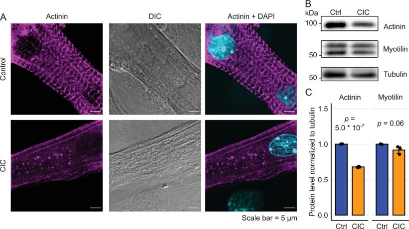 Sarkomere Desorganisation bei CIC