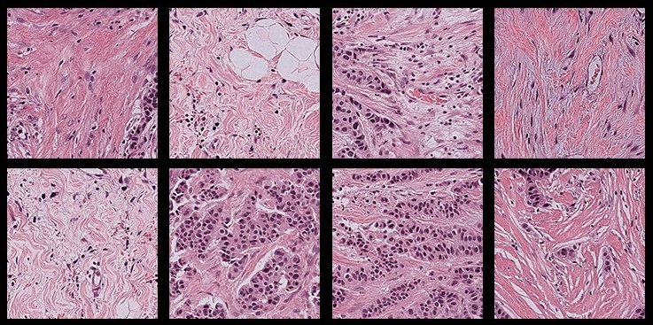 Eight H&E stained pathology samples, arranged in two rows of four squares
