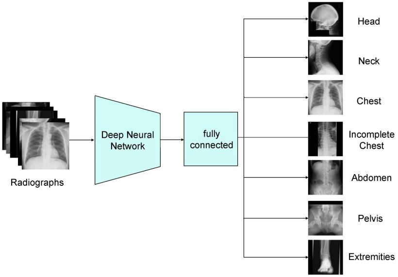 A workflow diagram for AI-based classification of xray images