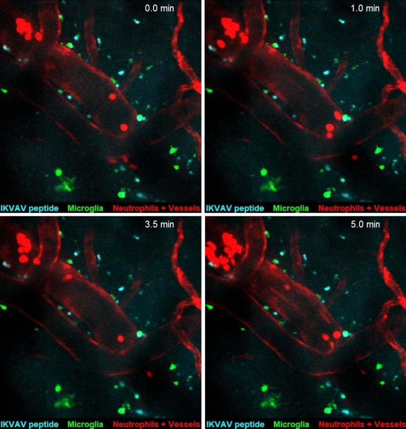 Sequence of four square screenshots showing blood vessels at different points...