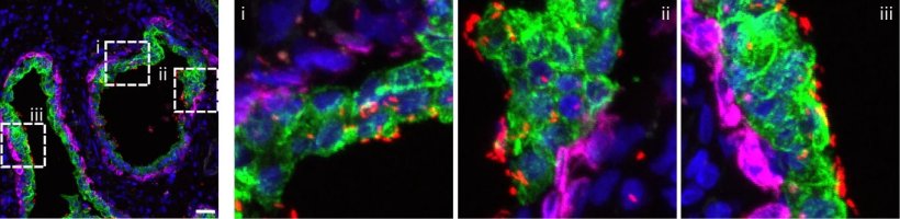 Vier Mikroskopie-Abbildungen von Prostatazellen in einer Reihe. Strukturen sind...