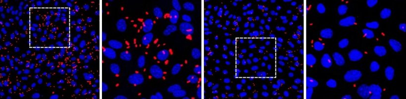 Vier Konfokalmikroskopie-Aufnahmen von Prostata-Organoiden in einer Reihe. Die...