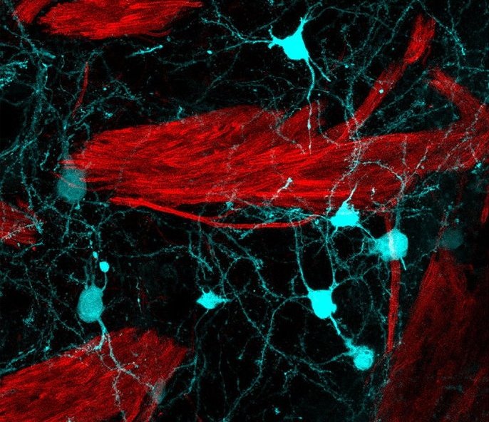 Fluoreszenzmikroskopische Aufnahme des Gehirns einer Maus. Die Myelinschicht...