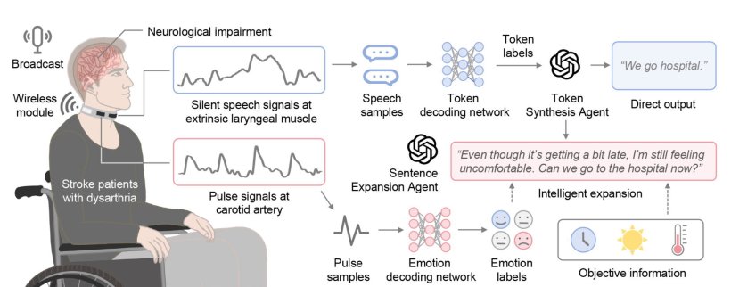 Schematic depiction of a system to restore speech for patients suffering from...