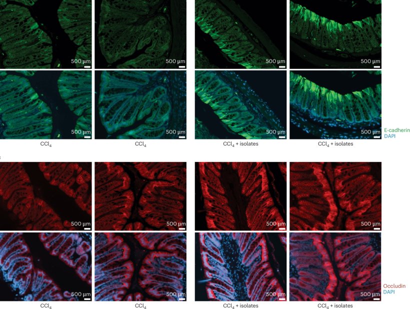 Zwei unterschiedlich eingefärbte Blöcke mit Proben aus Epithelzellen im...