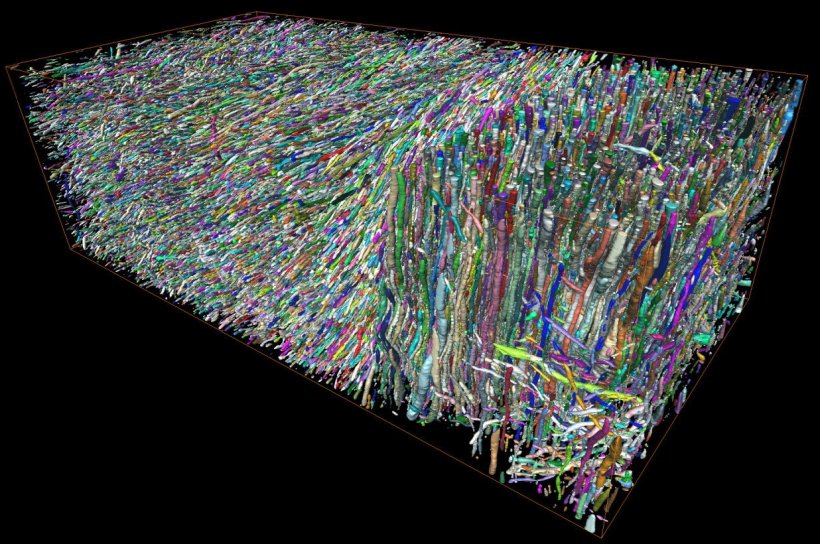 3-dimensional rectangular cutout with thousands of axon strands of brain tissue