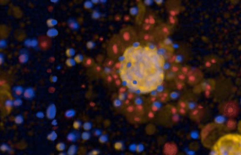 Eine runde gelbe Struktur, umgeben von kleineren blauen Punkten, vor einem...