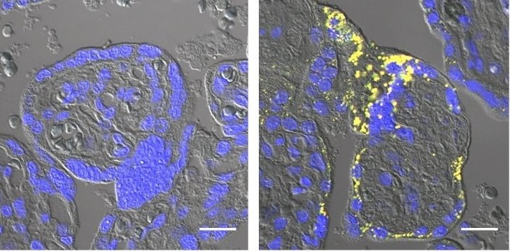 Two square microscopic images of placenta cells in blue against a grey...