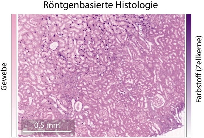 Farbiges Röntgenbild, statt in Schwarzweiß erscheinen die Strukturen der...