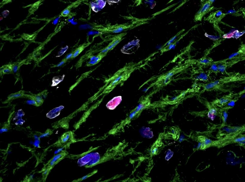 Cardiac cell structures in green and blue against a black background