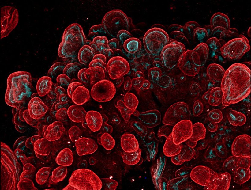 Accumulation of red cells against a black background