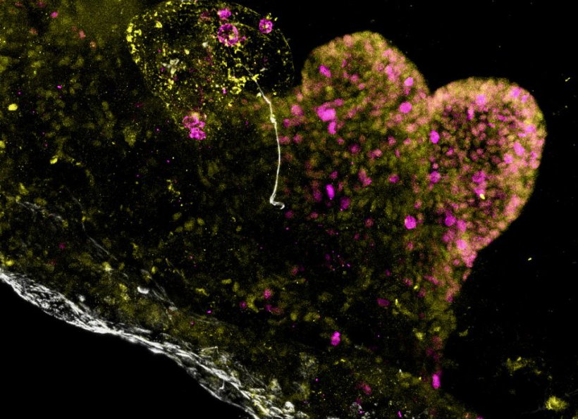 Aggregation of cells in olive tones, with sprinkles of magenta ans yellow...