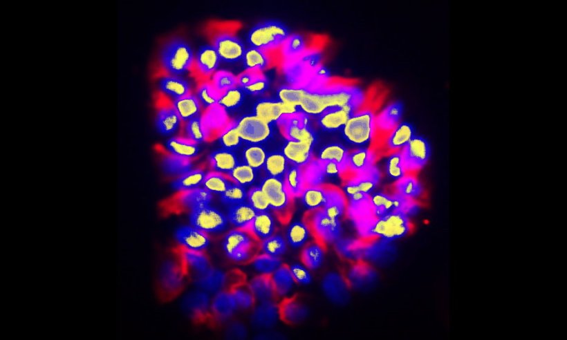Vaguely D-shaped accumulation of cells in pink, purple, and yellow tones...