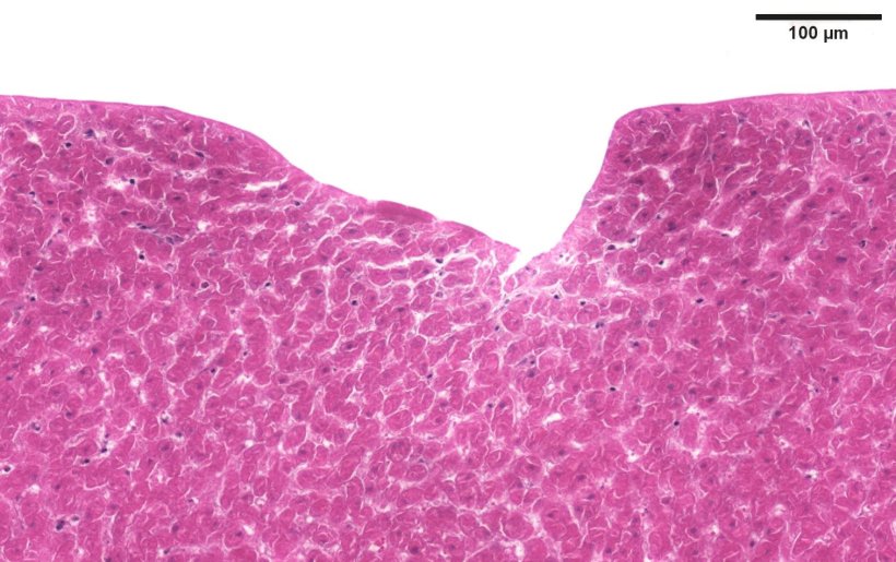A pink-stained liver cell sample, with a noticable dent in the upper border