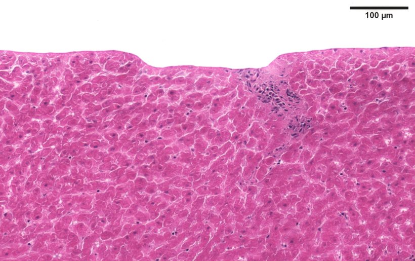 A pink-stained liver cell sample, with a very small dent in the upper border