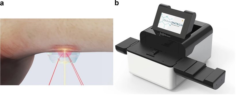 Zweigeteiltes Bild; auf der rechten Seite ist ein Ausschnitt eines Unterarms zu...