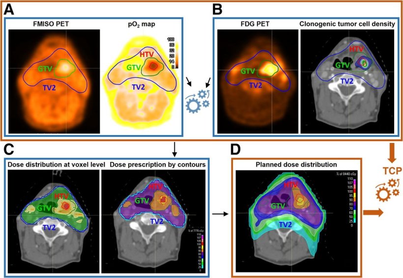 Seven Positron emission tomography (PET) images of a patient with head and neck...