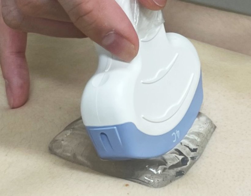 Closeup photo of a hand holding a medical ultrasound probe to a patients skin....
