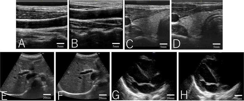 Eight medical ultrasound scans, arranged in two rows