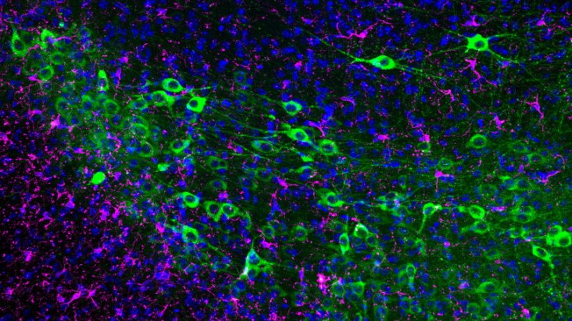 Neuron cells in blue, magenta, and green coloration
