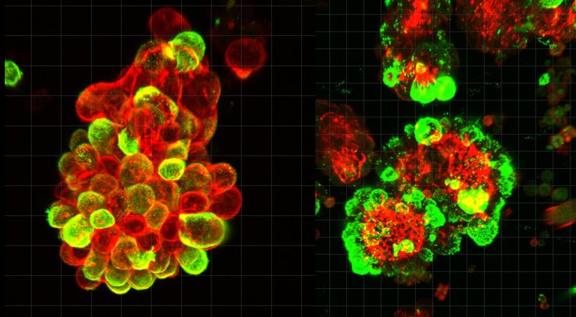 Two clusters of red and green cells against a black background