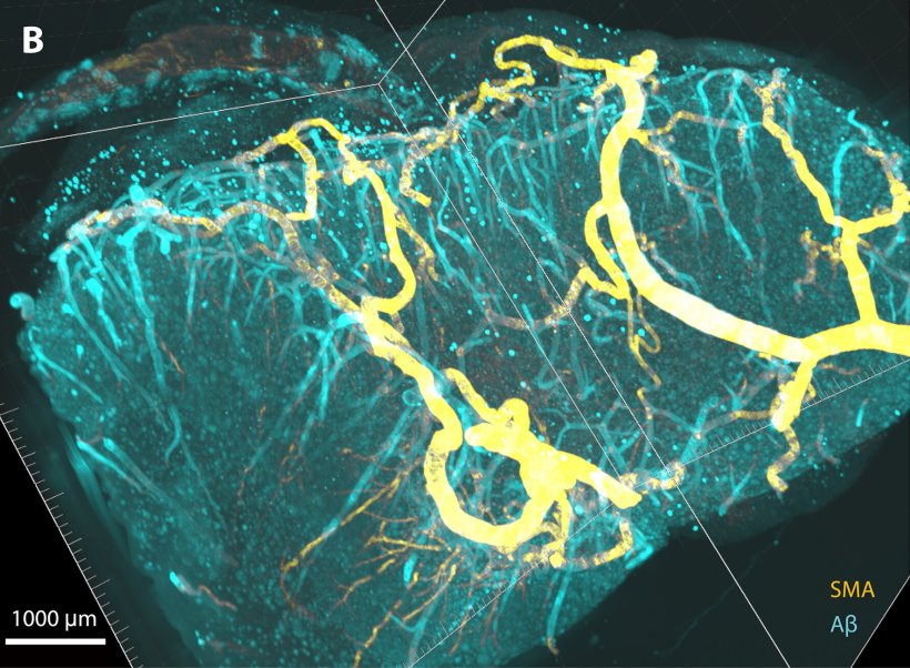 Vascular network in the brain in green and yellow against a black background