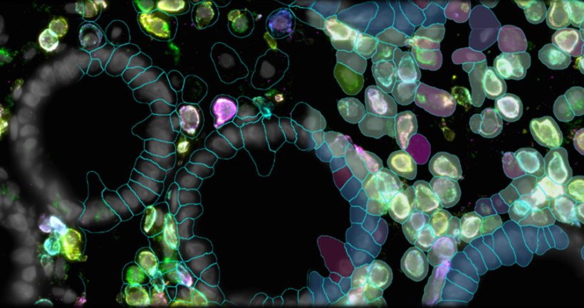 Zellen in unterschiedlichen Farben vor einem scharzen Hintergrund. Einige...