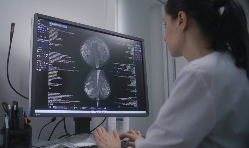 A female doctor examines mammography screening images on a computer screen for...