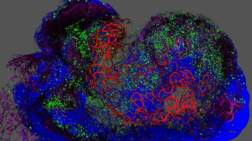 An accumulation of blue and green cells and tissue, with red worm-like wires,...