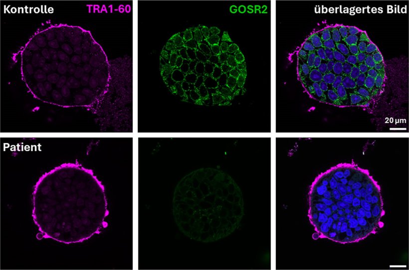 Sechs runde Zellstrukturen, angeordnet in einem 3x2-Raster. Die linken Zellen...