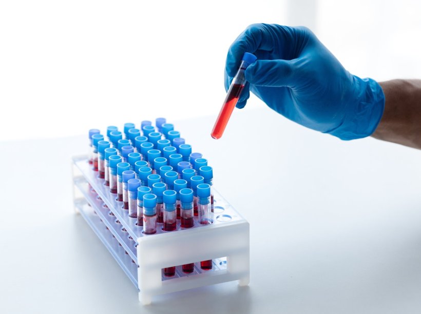 Eine hand im brauen Schutzhandschuh entnimmt ein Probenröhrchen mit einer...