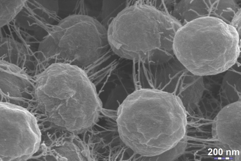 Scanning electron microscopy of sphere-shaped bacteria connected by a network...