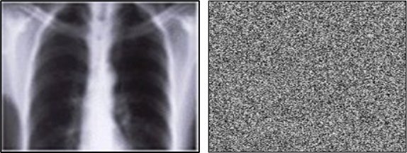 A chest X-ray image on the left side, and an equally-sized image of static...