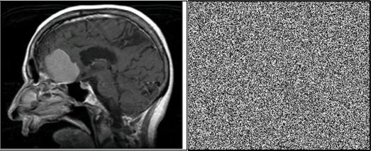 A head MRI image on the left side, and an equally-sized image of static noise...