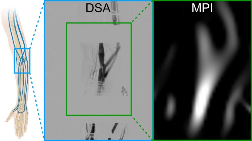 Vergleich unterschiedlicher Bildgebungs-Verfahren an den Venen im Arm eines...