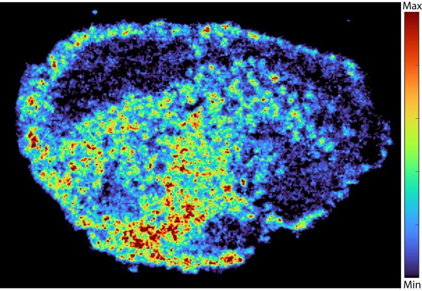 A somewhat oval accumulation of cells in thermal colors, against a black...