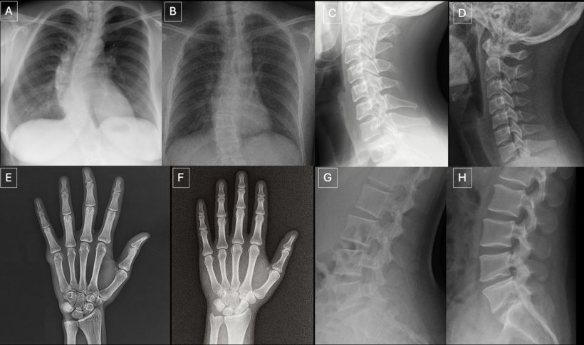 Four sets of xray images, from thorax, neck, left hand, and spine