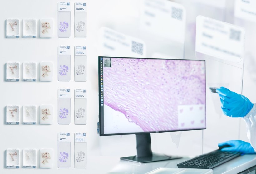 A computer monitor showing a digital pthology slide. From the right, a hand in...