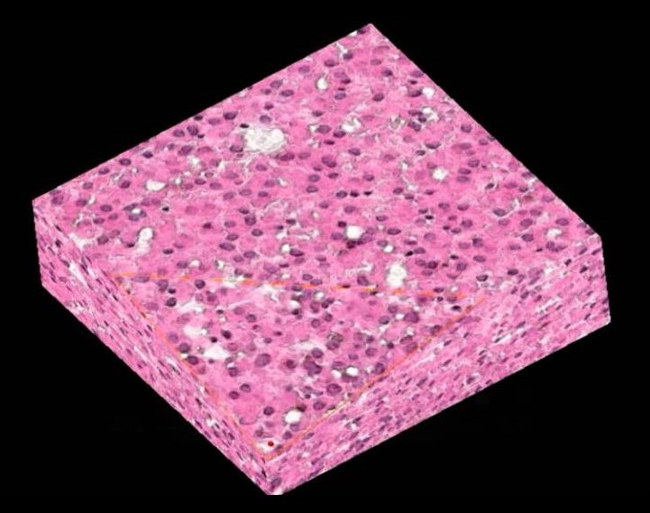Pink cuboid of H&E stained tissue sample against a black background
