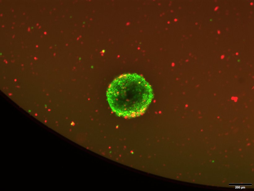 Aufnahme eines Mini-Tumors (Tumor-Organoids), an dem das Heidelberger...