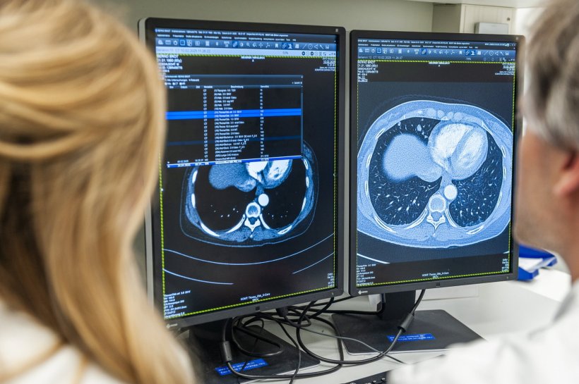 Zwei Radiologen schauen auf zwei Computermonitore mit CT-Aufnahmen der Lunge